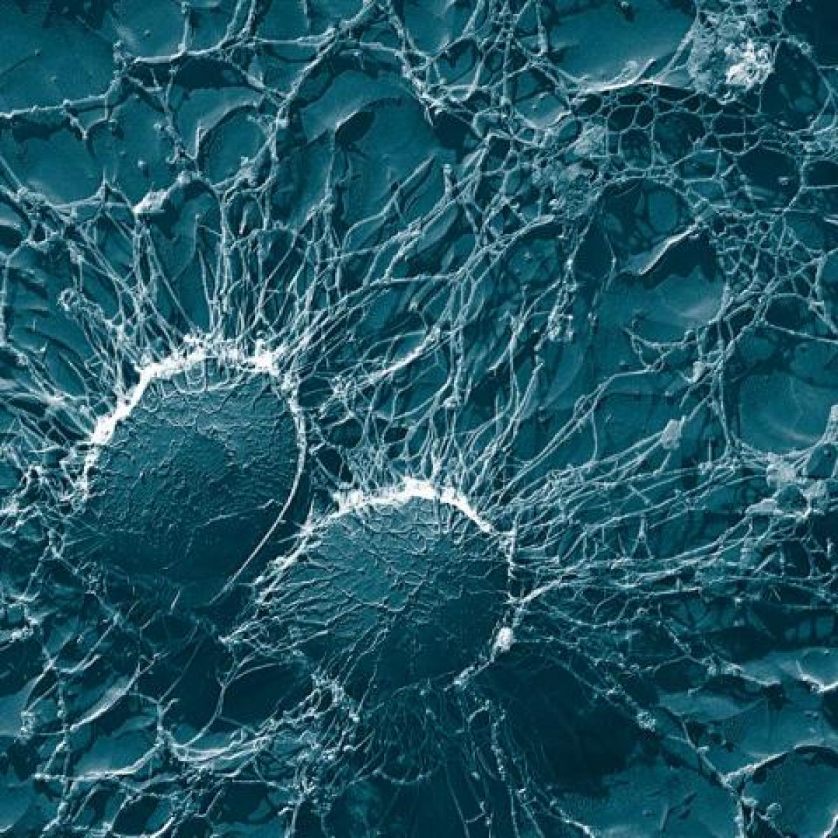 two cells viewed through a microscope with a blue background